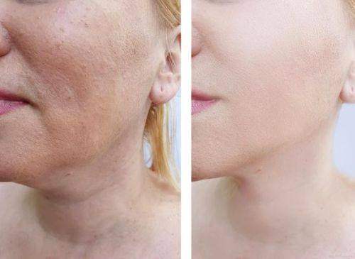 西安艺星医疗美容医院朱彬芳案例可靠不？医生持有效证，案例参考或助决策 