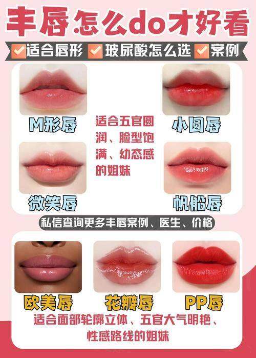 二、「上海玻尿酸丰唇去哪个医院比较好？从以下几个角度看：」