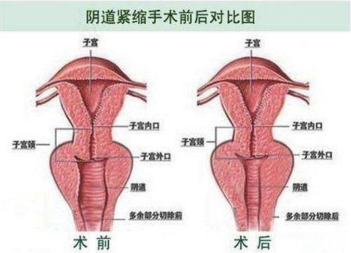 疤痕套餐
