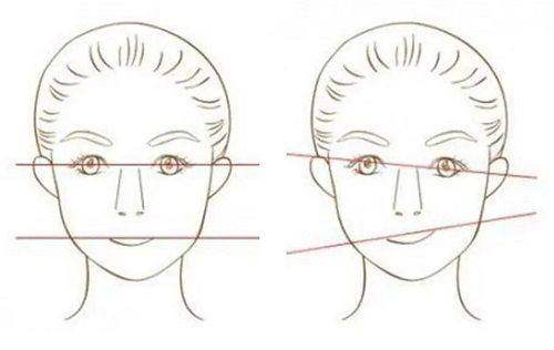 深圳悦尔疤痕医院真实评价怎么样？正规技术好，修复效果佳收费透明！ 