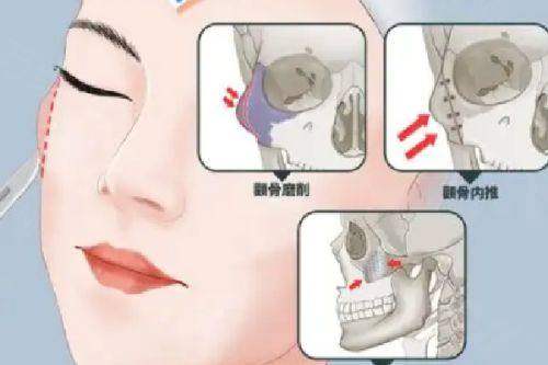 三、深圳南雅医疗美容医院口碑怎么样