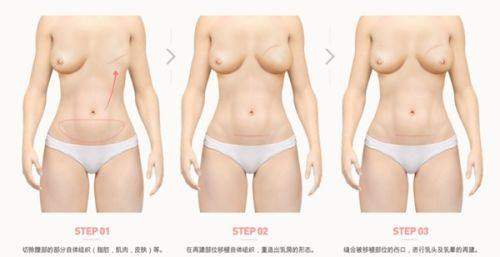 深圳南雅医疗美容门诊部口碑好吗？正规靠谱技术优，特色项目多值得了解！ 