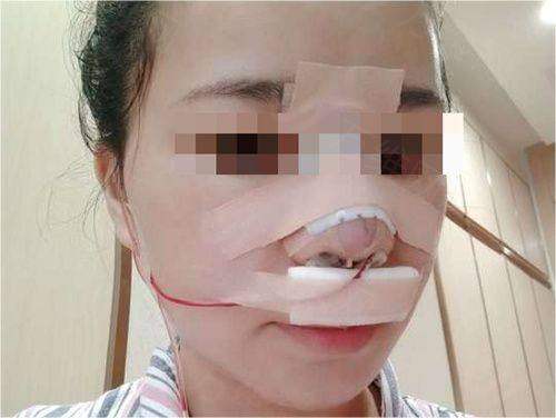 三、深圳伽美贝拉医疗美容在哪里啊