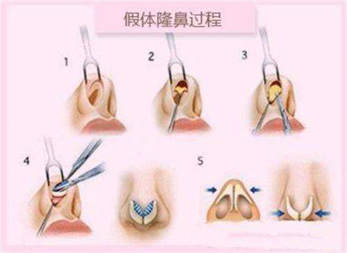 三、深圳伽美贝拉医疗美容是正规的吗