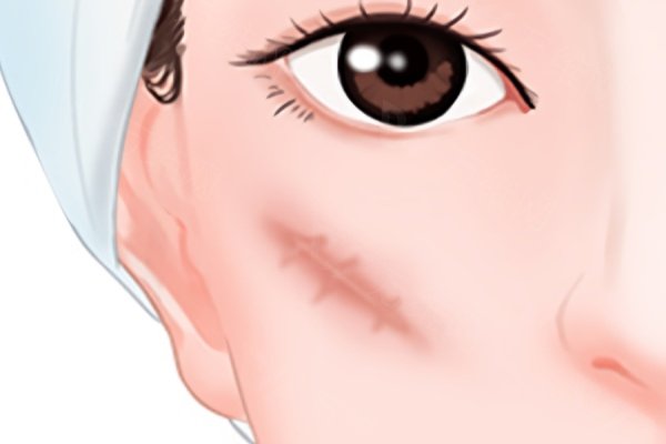 深圳南雅医疗美容门诊部营业时间：是每天10:00至20:00，实力强！