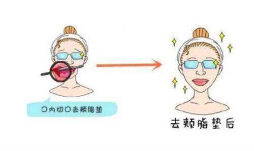 长沙黛妃医美医院地址在哪？长沙市天心区中意二路218号！靠谱！