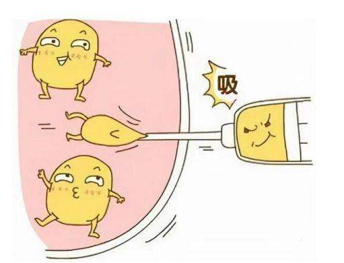 邵斌医生做吸脂手术技术优势：他精准分层吸脂效果显著且恢复快