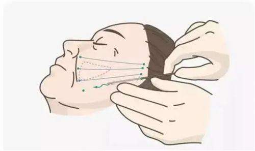 南京馒化脸修复医院哪家好？南京美莱、南京艺星、南京华美等医院排名前三 