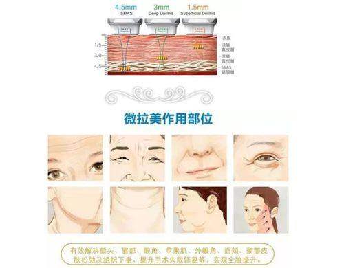 李建东维维提升是正规机构吗？答案揭晓，正规资质+技术优势打造可靠医美之选！ 