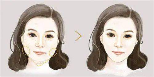 成都杨迪筋膜提升靠谱！专业医生+显著成效+快速恢复，让你安心变美！ 