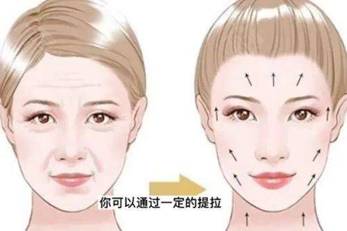 北京美莱打除皱医生名单：邱银先医生|付晓慧医生|刘卓医生做除皱好