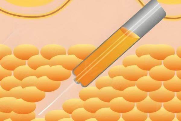 南宁韩美整形医院做吸脂医生口碑咋样？众多求美者认可其精湛专业技术