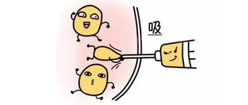 南京艺星医疗美容门诊部陈孝闯吸脂实例多吗？众多求美者认可其吸脂技术效果显著，实例丰富