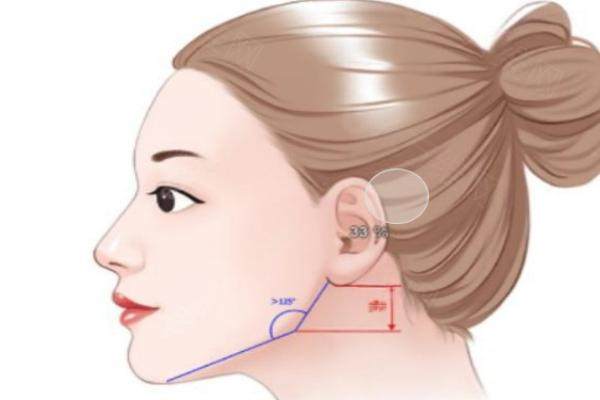 南京艺星整形医院汪树杰下颌角整形可信吗？真实患者反馈：术后脸型精致协调，效果自然持久
