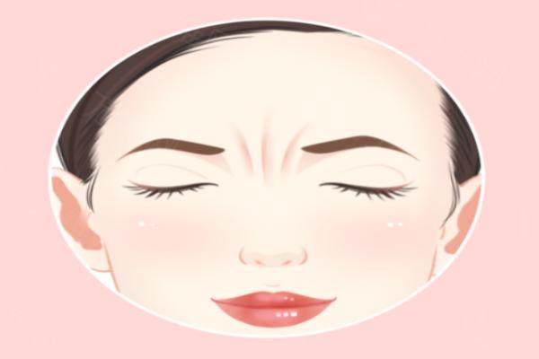 解永学在北京黄寺美容外科医院出诊，3年47例眉间“川字”纹手术，值得体验！ 