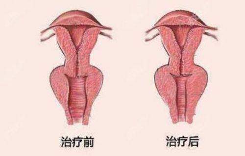重庆华美整形医院皮肤激光项目贵不贵？甜伊严选可以预约查嫩肤报价价格透明技术成熟，一键查询安心变美