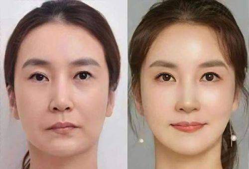 二、韩国reyou医院注射医生技术不错且擅长打造个性化唇部美学形态?www.zgszw.com