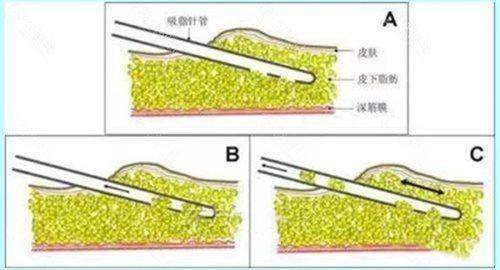 凯丽雅皮肤科热玛吉怎么约？首尔 Eonni 小程序一键预约直通韩国凯丽雅官方挂号
