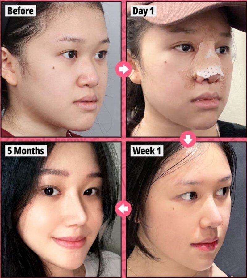 世美整形外科双眼皮修复怎么约？用首尔 Eonni 小程序锁朴相炫院长档期一键锁定高难度眼修复专家手术时间
