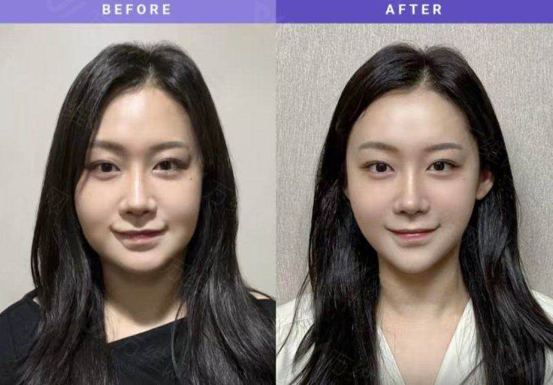 二、韩国S女性医院医生团队实力如何?女性专科面诊为何更懂你www.zgszw.com
