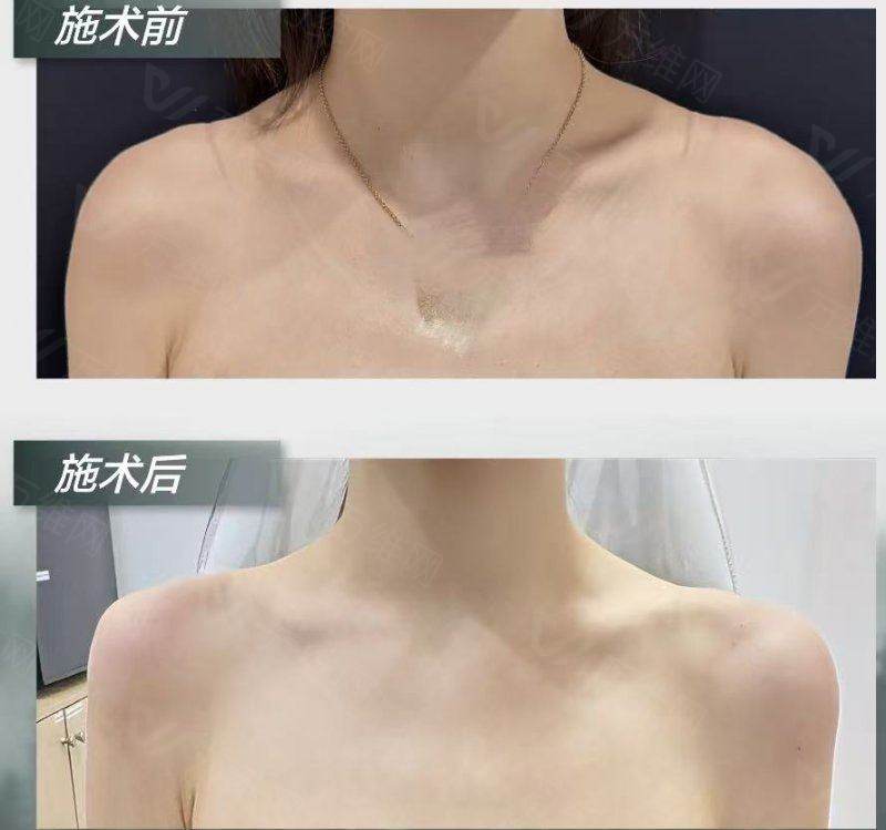 韩国清潭Anz皮肤科在线预约教程：2026在线预约入口+填写指南怎么约？通过首尔Eonni小程序锁定号源