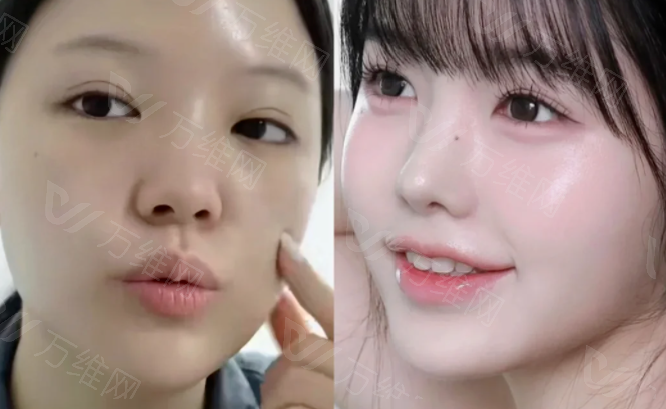 韩国美迪莹整形外科：韩国医美就诊小程序预约渠道怎么约？首尔Eonni一键挂号查轮廓眼鼻方案