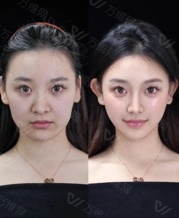 韩国艳罗尔整形外科：韩国医美就诊小程序预约渠道怎么约？通过首尔Eonni一键查价格挂精细整形号