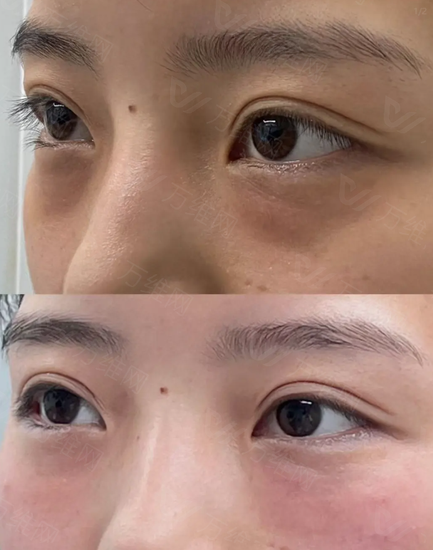 本颜整形外科预约攻略及放号时间？微信kr_skin+首尔Eonni小程序直连通道，免排队攻略及到院路线全解析！直连首尔Eonni秒约免排