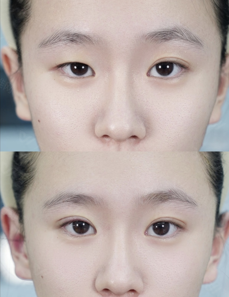 Elev医院预约通道在哪？微信kr_skin+首尔Eonni小程序双通道，高人气机构随时约不用愁！