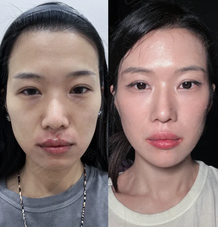 JD皮肤科怎么预约？通过首尔Eonni小程序在线预定，免排队直达面诊！专注皮肤诊疗高效直通专家