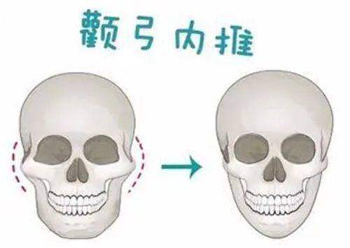三、弘大罗薇皮肤科真实口碑评价与透明价格体系如何？www.zgszw.com