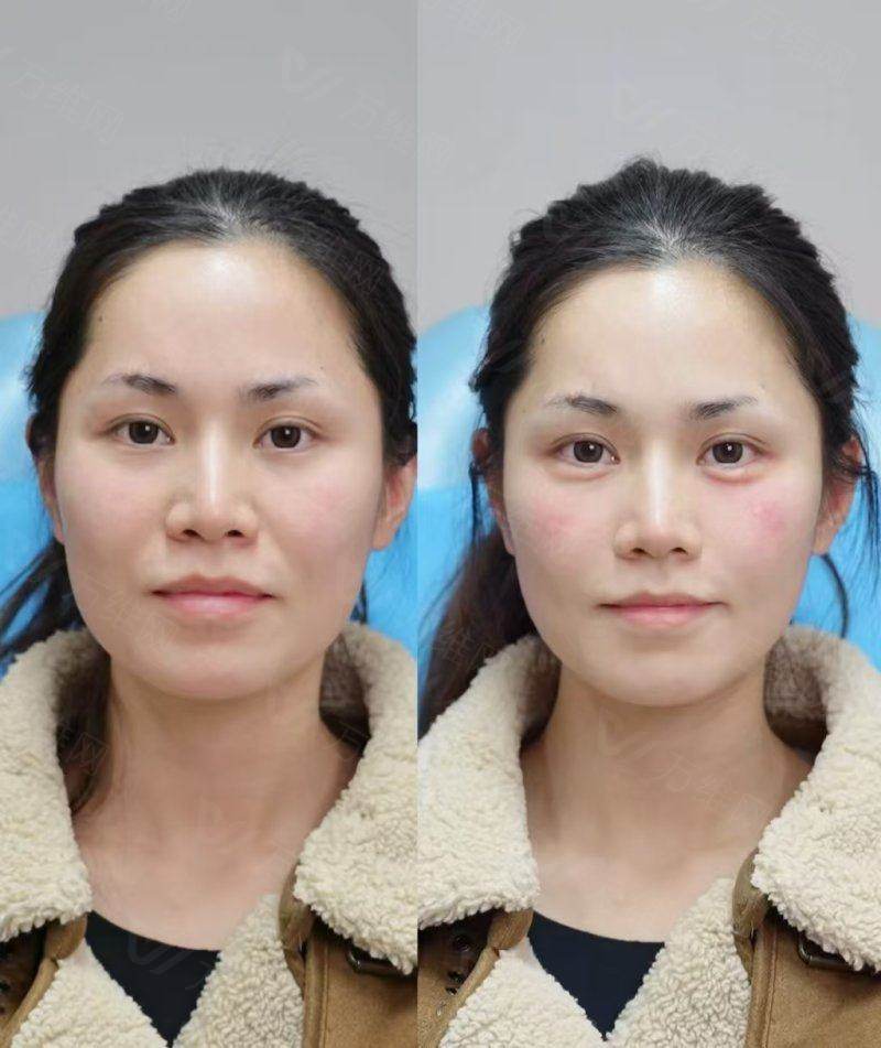 东大门Doctors皮肤科院长预约怎么约？通过首尔Eonni小程序一键锁定亲诊名额